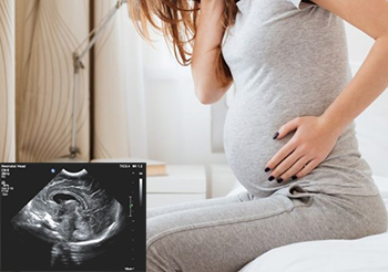 Скрининговое УЗИ 1-го триместра беременности